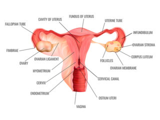 Cervical Cancer