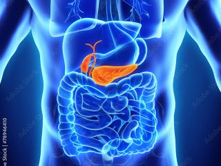 Pancreatic-Cancer-320x240